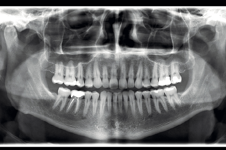 planmeca-2d | Curran Dental LTD